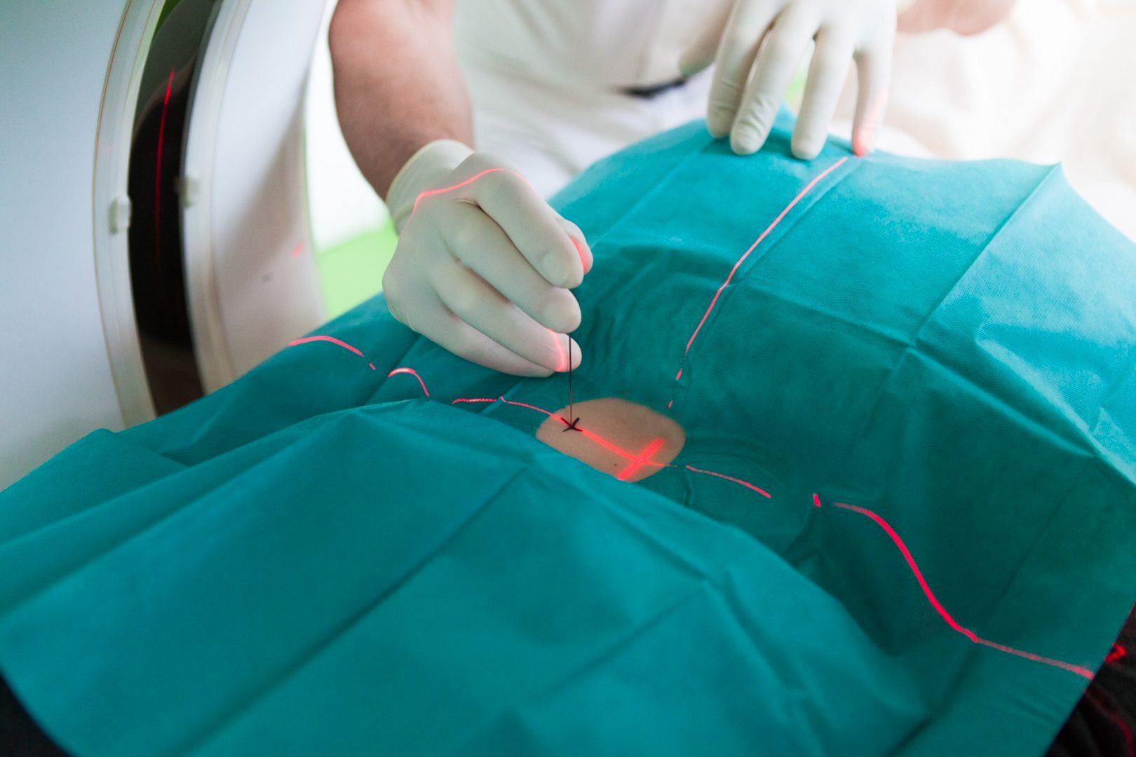 CTgesteuerte Schmerztherapie (PRT) Radiologie am Kaiserteich